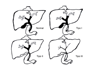 ANATOMIA DE LA ATRESIA