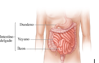 INTESTINO DELGADO ATRESIA