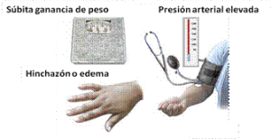 Síntomas de preeclampsia