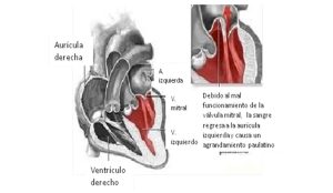 cardiopatia3