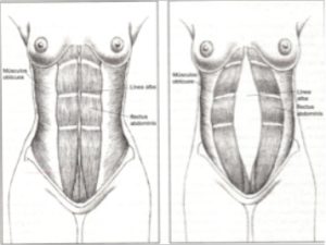 dolorespalda4