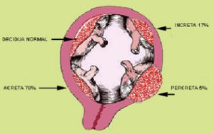 placenta 6
